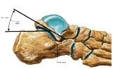 Anatomie: heup,bovenbeen,knie,onderbeen,enkel,voet,acetabulum,collum femoris,trachanter,femur,epicondyl,meniscus,kruisband,cruciate ligament,patella,knieschijf,tibia,fibula,malleolus,talus,calcaneus,tarsus,metatarsus,phalanx,falanx,quadriceps femoris,rectus femoris,sartorius,tensor fasciae latae,tractus iliotibialis,biceps femoris,gastrocnemius,semimembranosus,semitendinosus,soleus,suralis,vena saphena parva,vena saphena magna,sciatic,ischiadicus,peronea